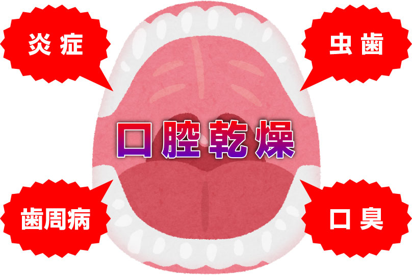 口腔乾燥のリスク図