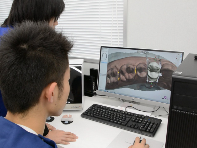 コンピュータを使って被せ物を削り出す最新の歯科治療技術